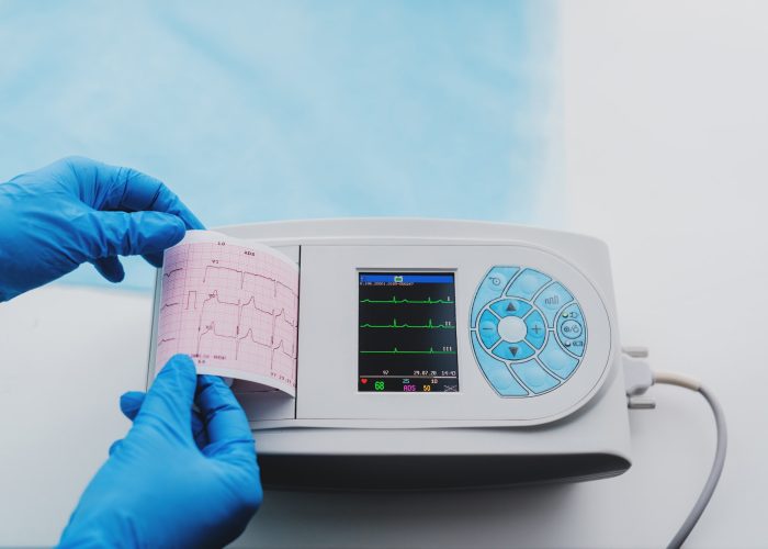 Close up view of ECG machine display and print out trip chart indicating pulse tare