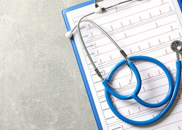 Stethoscope and clipboard with electrocardiogram on gray background