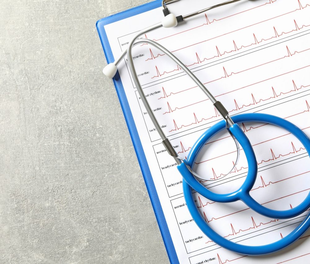 Stethoscope and clipboard with electrocardiogram on gray background